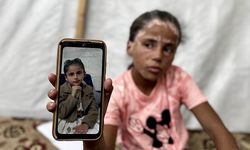 İşgalci İsrail'in saldırıları nedeniyle saçlarına ak düşen Filistinli kız eski günlerine dönmek istiyor