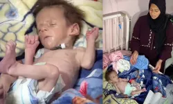 1.5 kilo Gazzeli Yusuf, açlığa yenik düştü