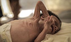 MSF: Gazze’de akut yetersiz beslenen 5 yaş altı çocuk sayısı 3 kat arttı