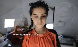 İsrail, Gazze'de binlerce kişiyi kör etti