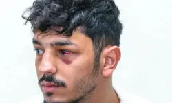 13 İsrailli polis, Filistinli güvenlik görevlisini darp etti