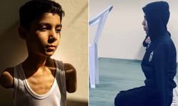 Siyonist bombaları kollarını aldı ama imanını alamadı