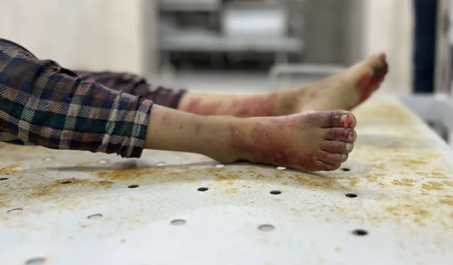 Yine BBC, yine sansür: Gazze doktorları belgeseli neden yayınlanmıyor?