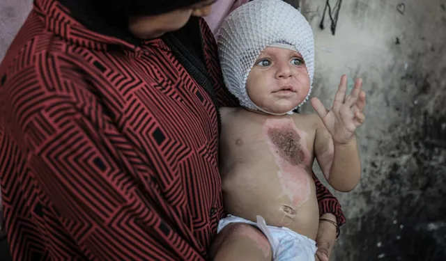 İngiltere, Gazzeli çocukları ilk kez ülkeye getiriyor