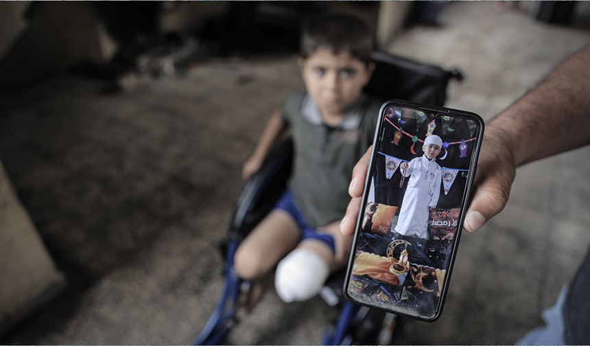 Filistinli çocuk protez bacak sahibi olmayı bekliyor